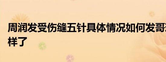 周润发受伤缝五针具体情况如何发哥现在怎么样了