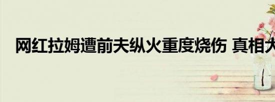 网红拉姆遭前夫纵火重度烧伤 真相大曝光