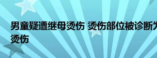 男童疑遭继母烫伤 烫伤部位被诊断为深二度烫伤