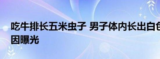吃牛排长五米虫子 男子体内长出白色虫子原因曝光