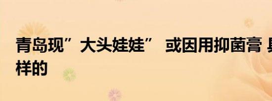 青岛现”大头娃娃” 或因用抑菌膏 具体是怎样的