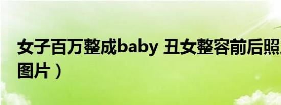 女子百万整成baby 丑女整容前后照片曝光（图片）