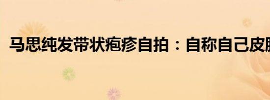 马思纯发带状疱疹自拍：自称自己皮肤真好