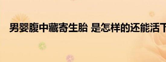 男婴腹中藏寄生胎 是怎样的还能活下来吗