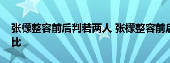 张檬整容前后判若两人 张檬整容前后照片对比
