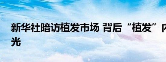 新华社暗访植发市场 背后“植发”内幕大曝光