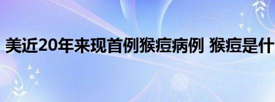 美近20年来现首例猴痘病例 猴痘是什么病毒
